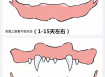 狗长牙的顺序图解 狗狗长牙是几个月
